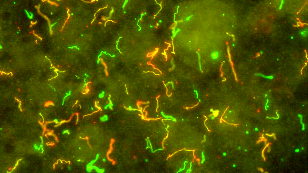 Krętki Borrelia pod mikroskopem Borelioza - krętki Borrelia pod mikroskopem