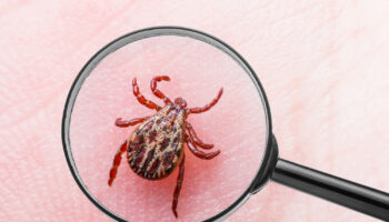 Objawy boreliozy - Jak rozpoznać wczesne zakażenie